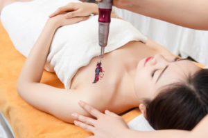 xoa-xam-laser-co-an-toan-khong