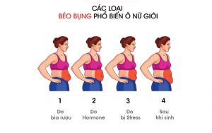 Các loại béo bụng thường gặp