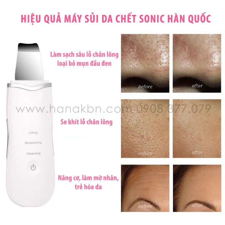 Công dụng và hiệu quả nổi bật của máy Sonic Skin Scrubber
