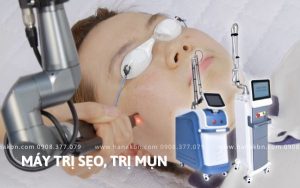 Hình ảnh máy điều trị sẹo, sẹo mụn hiệu quả