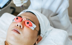 Điều trị sẹo đúng cách giúp da khỏe đẹp, mịn màng