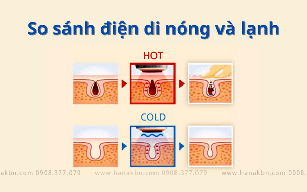 Cách thức hoạt động của điện di nóng và lạnh.