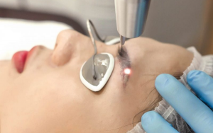 Cách xóa xăm chân mày không để lại sẹo?