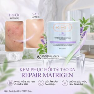 kem-matrigen-phuc-hoi-da-bong-troc-kich-ung