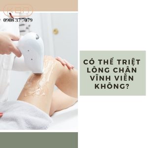 co-the-triet-long-chan-vinh-vien-khong