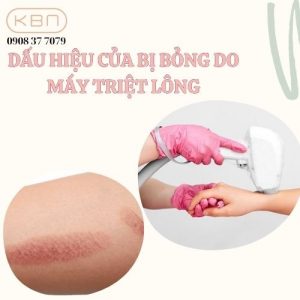dau-hieu-cua-bi-bong-do-may-triet-long