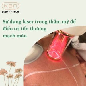 su-dung-laser-trong-tham-my-de-dieu-tri-ton-thuong-mach-mau