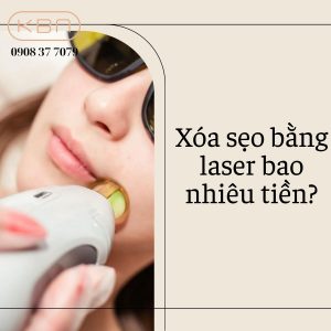 xoa-seo-bang-laser-bao-nhieu-tien