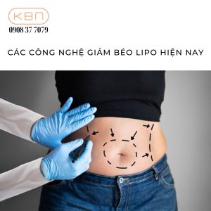 cac-cong-nghe-giam-beo-lipo-hien-nay