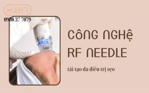Khám phá công nghệ RF Needle tái tạo da điều trị sẹo hiệu quả