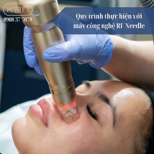 quy-trinh-thuc-hien-voi-may-cong-nghe-rf-needle