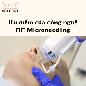 uu-diem-cua-cong-nghe-rf-microneedling