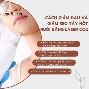 cach-giam-dau-va-giam-seo-tay-not-ruoi-bang-laser-co2