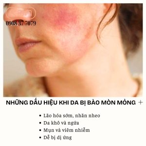 dau-hieu-da-body-bi-bao-mon