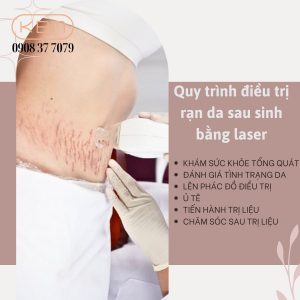 dieu-tri-ran-da-sau-sinh-bang-laser-bao-nhieu-tien