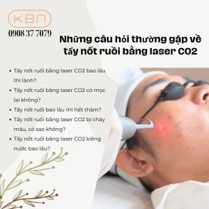 nhung-cau-hoi-thuong-gap-ve-tay-not-ruoi-bang-laser-co2