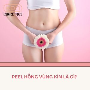 peel-vung-kin