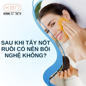 sau-khi-tay-not-ruoi-co-nen-boi-nghe-khong