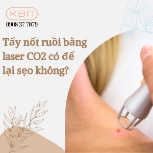 tay-not-ruoi-bang-laser-co2-co-de-lai-seo-khong