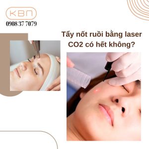 tay-not-ruoi-bang-laser-co2-co-het-khong