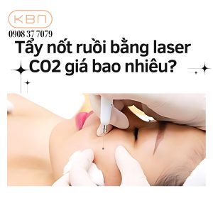 tay-not-ruoi-bang-laser-co2-gia-bao-nhieu