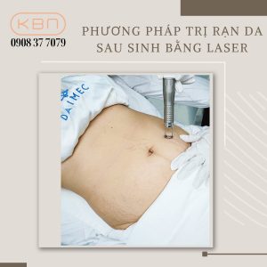 tri-ran-da-sau-sinh-bang-laser-hieu-qua