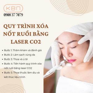 xoa-not-ruoi-bang-laser-gia-bao-nhieu