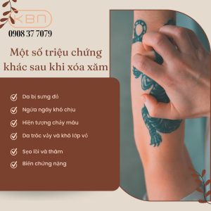 xoa-xam-noi-bong-nuoc