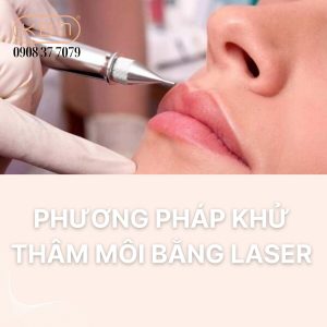 khu-tham-moi-bang-laser