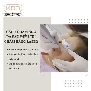 xoa-cham-bang-laser