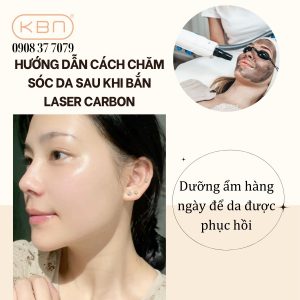 cham-soc-da-sau-khi-ban-laser-carbon-cho-khach-hang