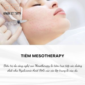 cong-nghe-tre-hoa-da-ultherapy