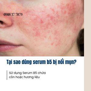 da-noi-mun-khi-dung-serum-b5