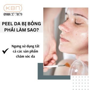 peel-da-bi-bong-non-phai-lam-sao