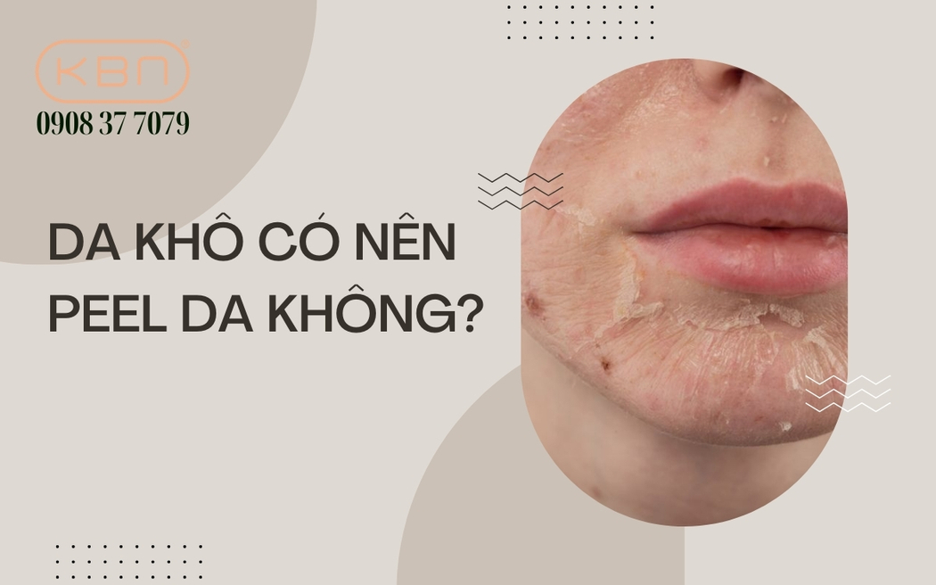 Da khô có nên peel da không? Sản phẩm peel da cho da khô