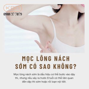 bao-nhieu-tuoi-thi-duoc-nho-long-nach