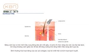 may-cham-soc-da-skinpro-max-chat-luong