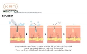 may-cham-soc-da-skinpro-max-gia-tot