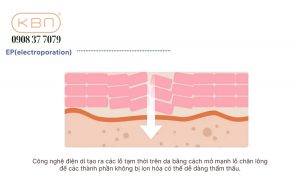 may-tham-my-skinpro-max