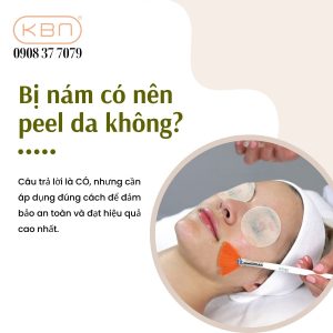 bi-nam-co-nen-peel-da-khong