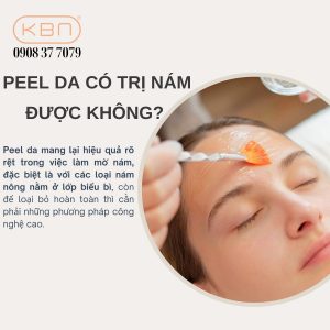 peel da có trị nám được không