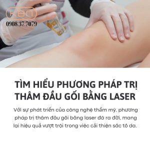 laser-tri-tham-dau-goi