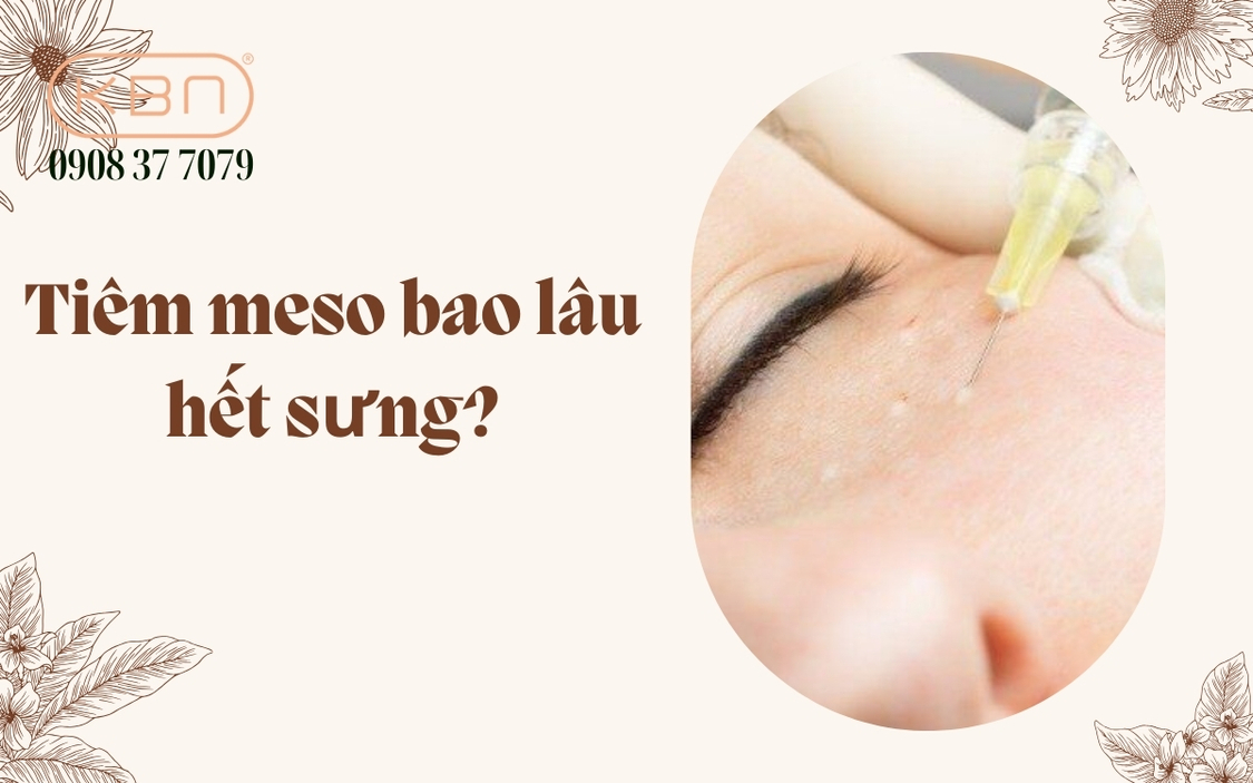 Tiêm meso bao lâu hết sưng? Tiêm meso bao lâu thì tan?