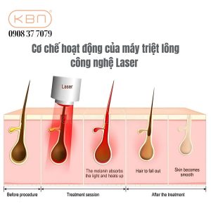 co-che-hoat-dong-cua-may-triet-long-mini