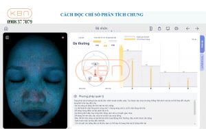 hinh-anh-soi-da-mat-chi-so-ba-nhon-cua-may-focuskin