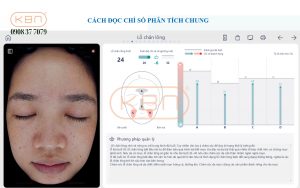 hinh-anh-soi-da-mat-chi-so-lo-chan-long-cua-may-focuskin