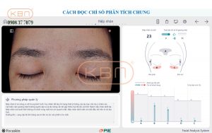 hinh-anh-soi-da-mat-chi-so-nep-nhan-cua-may-focuskin