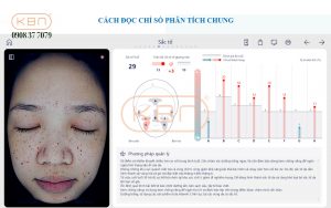 hinh-anh-soi-da-mat-chi-so-sac-to-da-cua-may-focuskin