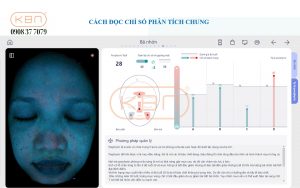 hinh-anh-soi-da-mat-chi-so-ty-le-porphyrin-cua-may-focuskin