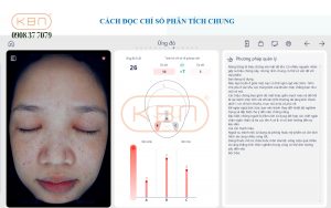 hinh-anh-soi-da-mat-chi-so-ung-do-cua-may-focuskin